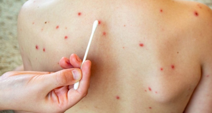 La Columna del Dr. Celeste