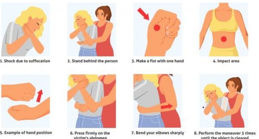Maniobra de Heimlich