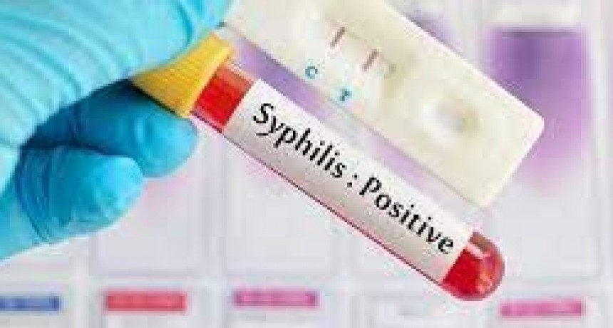 La Columna del Dr. Celeste del miércoles 4 de septiembre