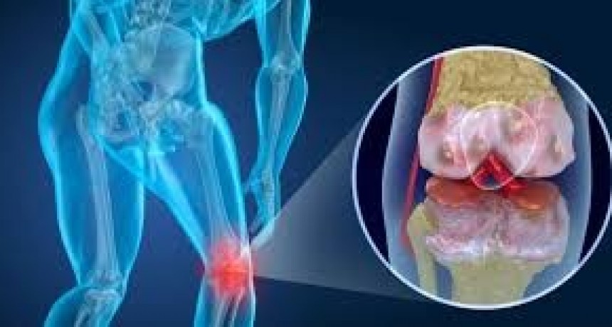 La Columna del Dr. Celeste