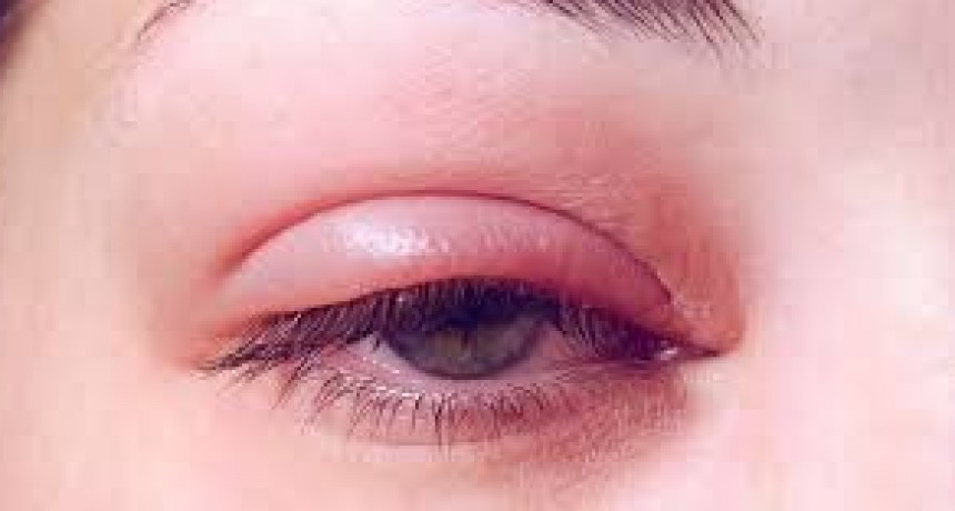 La columna del Dr. Celeste